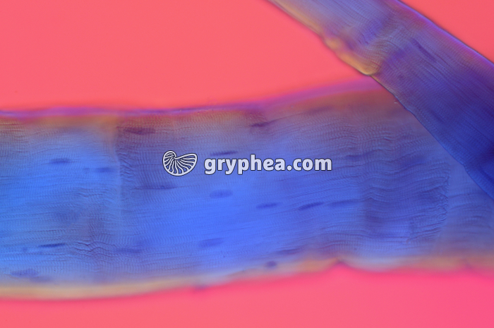 Fibre musculaire BM x200 - gryphea.com